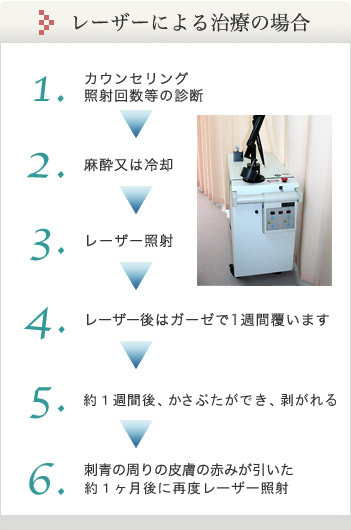 レーザーによる治療の場合