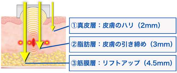 3種類のカートリッジ
